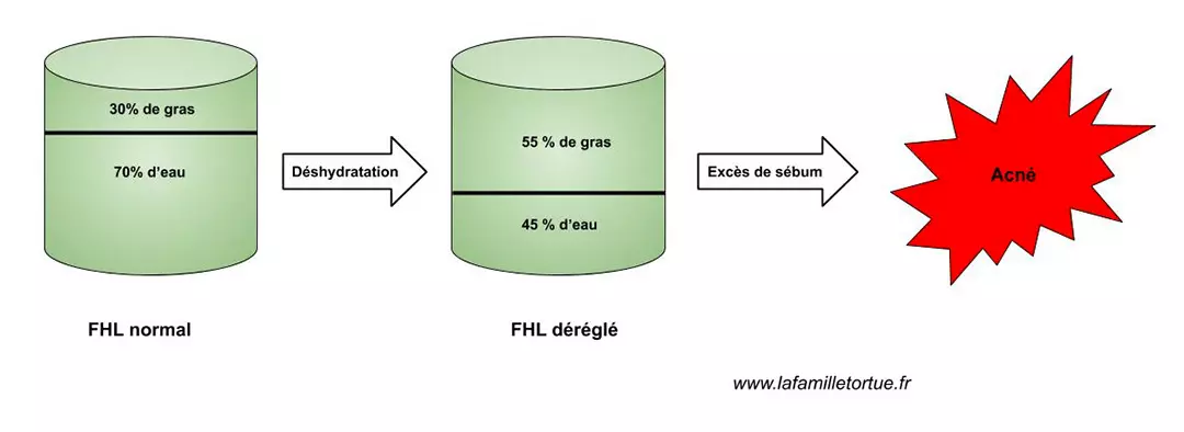 FHL déréglé