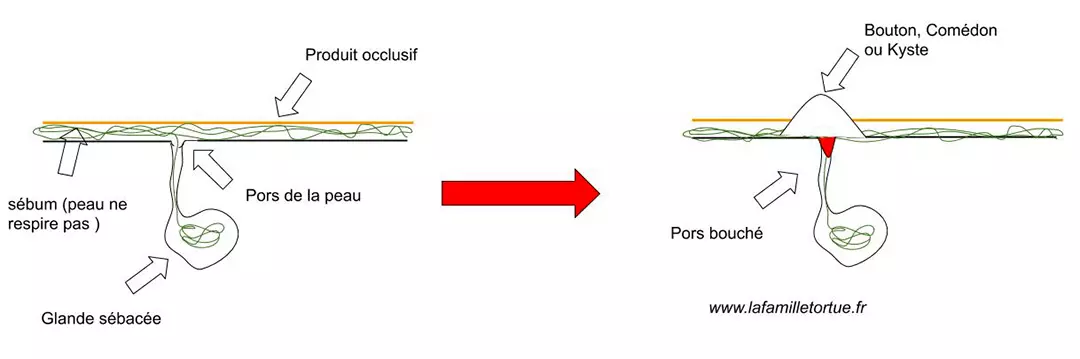 Produit occlusif sur la peau